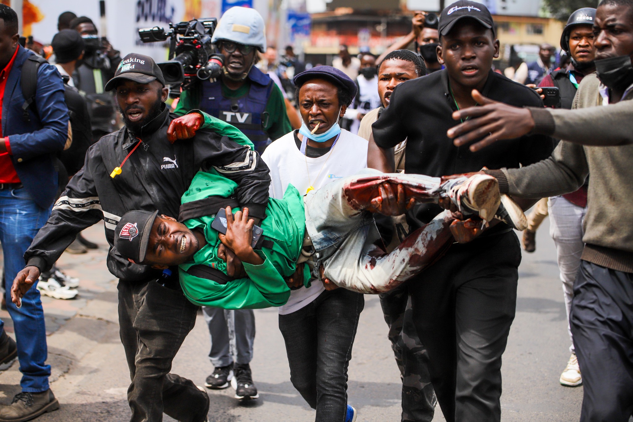 A group of protesters carry a young injured man through the streets of Nairobi during a demonstration. His jeans are soaked in blood, and his face is contorted in pain as he clutches his phone. The people around him, some with bloodstained hands, look determined and urgent. In the background, journalists and other protesters capture the unfolding chaos, highlighting the intensity of the moment.